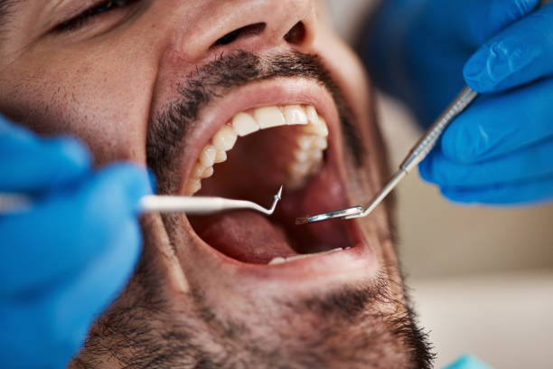 Best Emergency Dental Care for Sports Injuries in Asheboro, NC