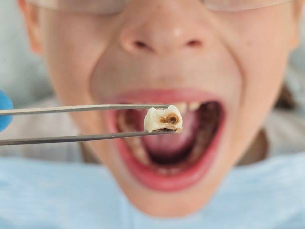 Best Weekend Emergency Dental Services in Asheboro, NC